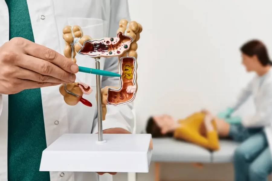 objawy raka jelita grubego